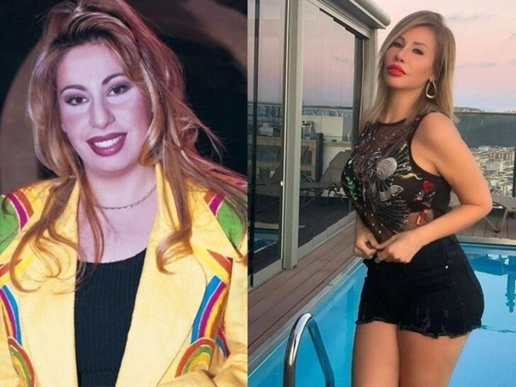 Ünlülerin hayatlarını estetik değiştirdi! Pınar Deniz, Gülsüm Ali, Melek Mosso estetiksiz halleri 8
