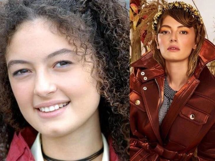 Ünlülerin hayatlarını estetik değiştirdi! Pınar Deniz, Gülsüm Ali, Melek Mosso estetiksiz halleri 9