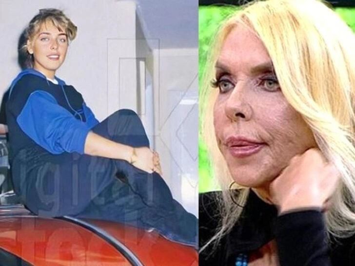 Ünlülerin hayatlarını estetik değiştirdi! Pınar Deniz, Gülsüm Ali, Melek Mosso estetiksiz halleri 10
