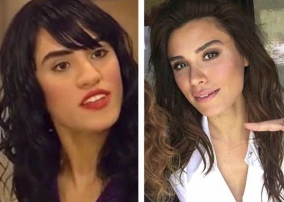 Ünlülerin hayatlarını estetik değiştirdi! Pınar Deniz, Gülsüm Ali, Melek Mosso estetiksiz halleri 13