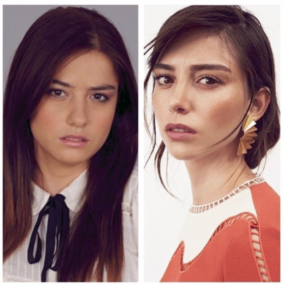 Ünlülerin hayatlarını estetik değiştirdi! Pınar Deniz, Gülsüm Ali, Melek Mosso estetiksiz halleri 15