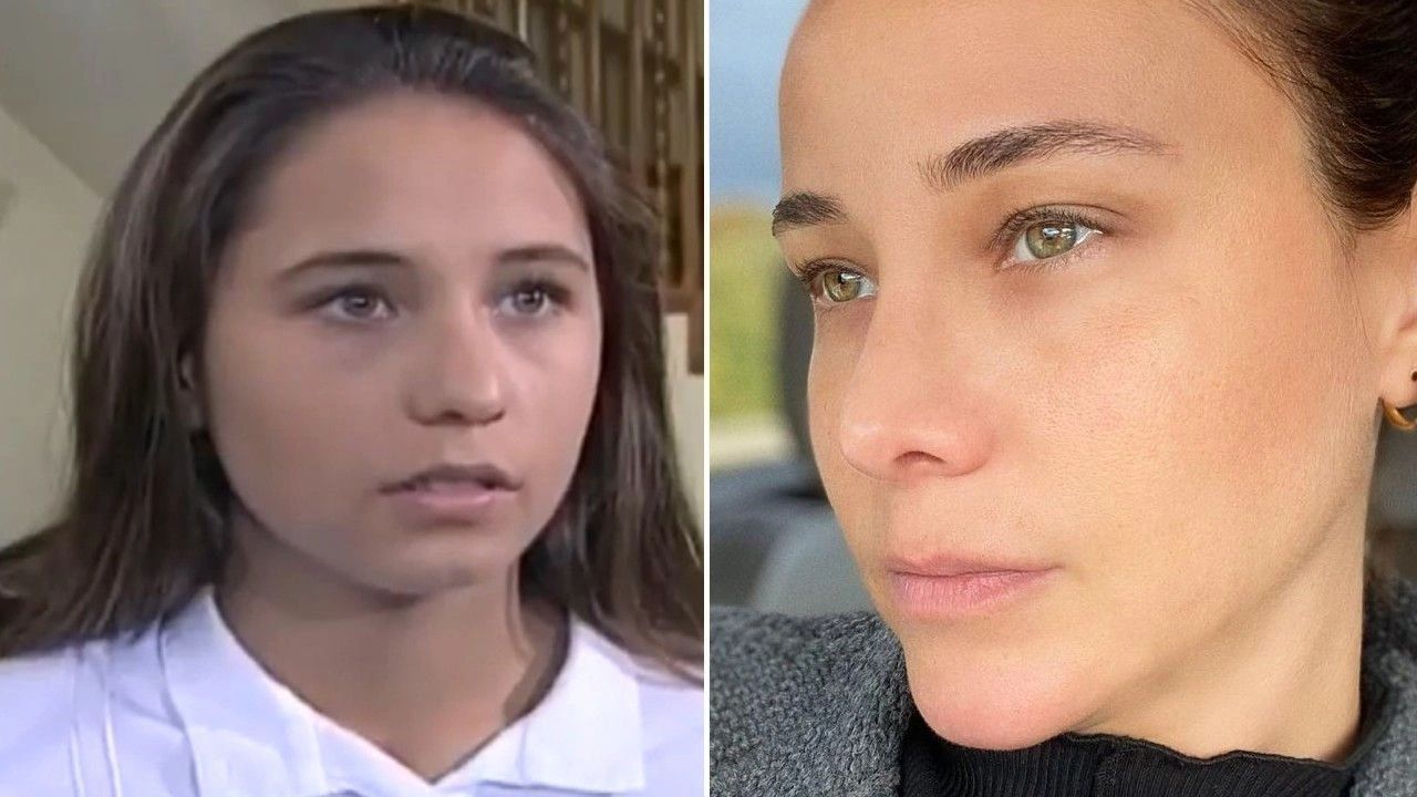 Ünlülerin hayatlarını estetik değiştirdi! Pınar Deniz, Gülsüm Ali, Melek Mosso estetiksiz halleri 16