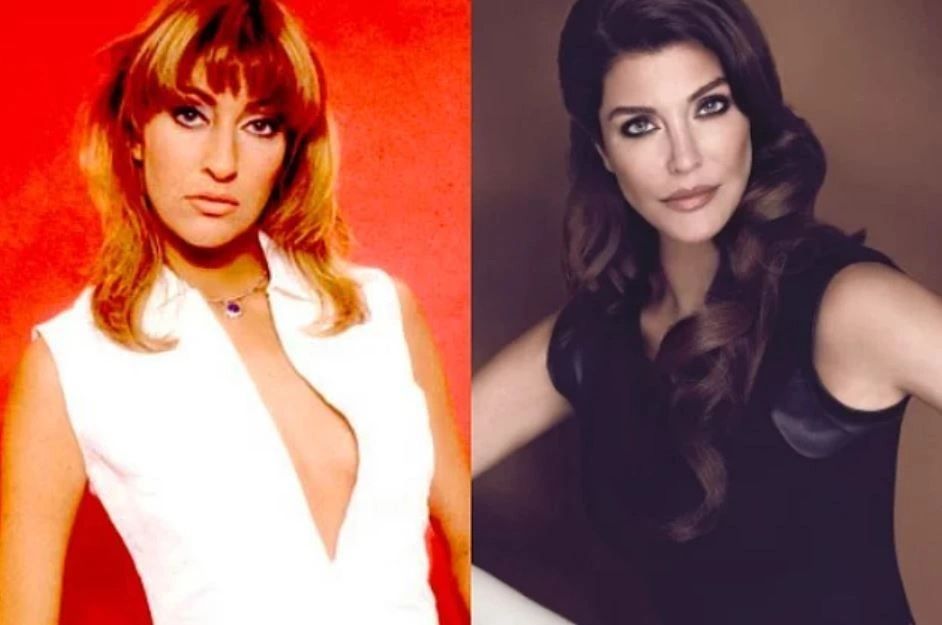 Ünlülerin hayatlarını estetik değiştirdi! Pınar Deniz, Gülsüm Ali, Melek Mosso estetiksiz halleri 20