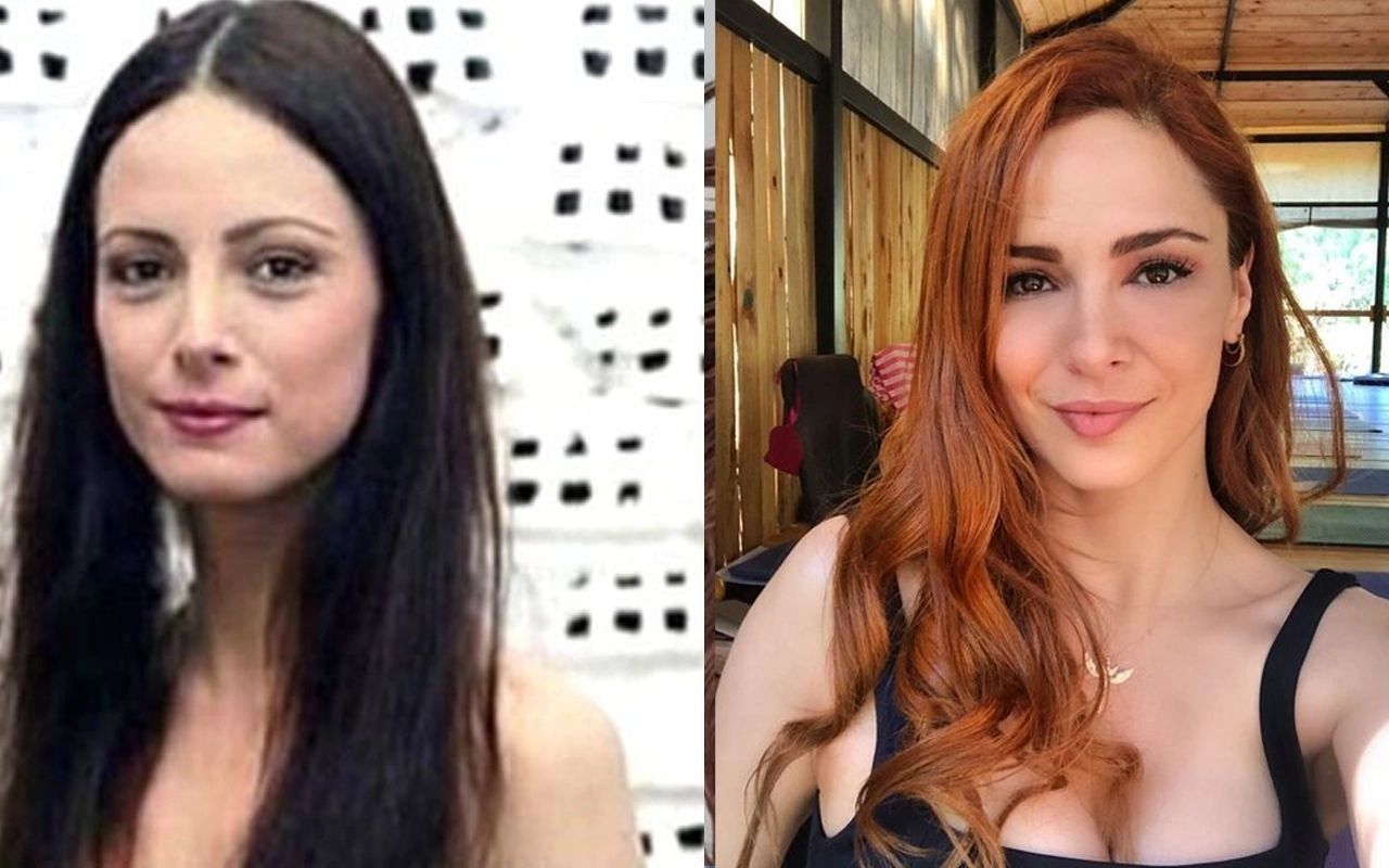 Ünlülerin hayatlarını estetik değiştirdi! Pınar Deniz, Gülsüm Ali, Melek Mosso estetiksiz halleri 21
