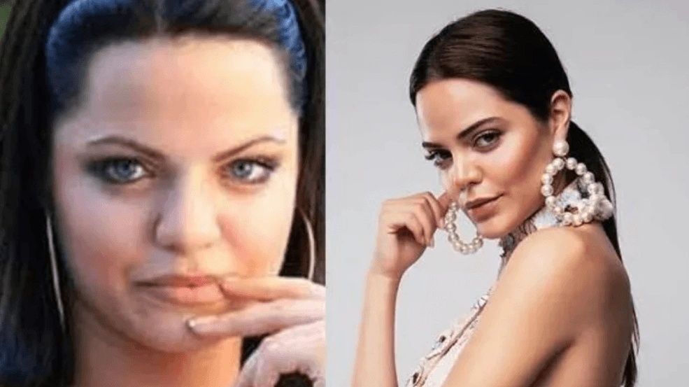 Ünlülerin hayatlarını estetik değiştirdi! Pınar Deniz, Gülsüm Ali, Melek Mosso estetiksiz halleri 22