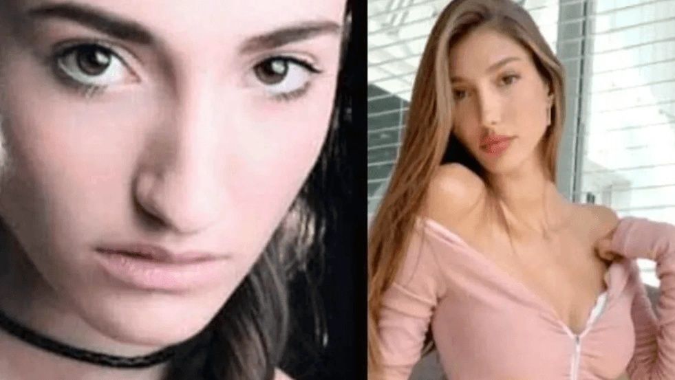 Ünlülerin hayatlarını estetik değiştirdi! Pınar Deniz, Gülsüm Ali, Melek Mosso estetiksiz halleri 23
