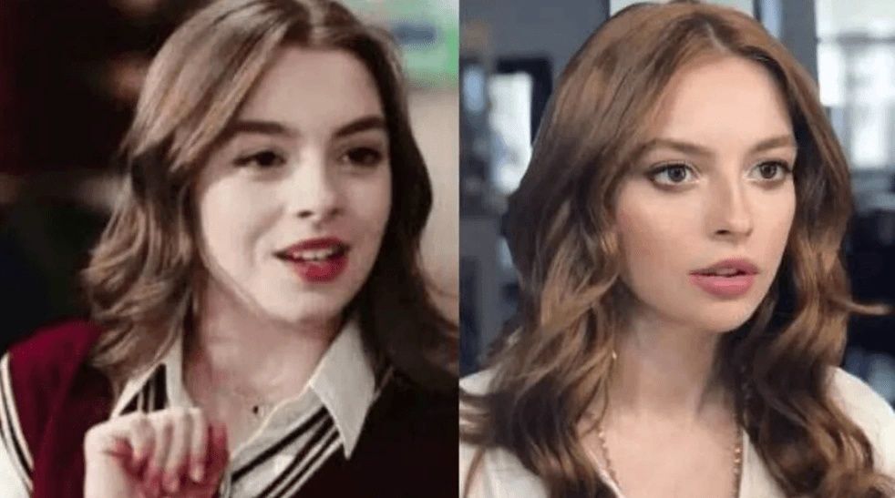 Ünlülerin hayatlarını estetik değiştirdi! Pınar Deniz, Gülsüm Ali, Melek Mosso estetiksiz halleri 24