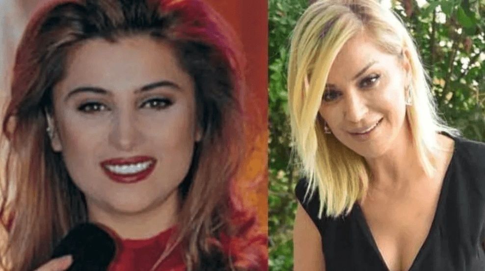 Ünlülerin hayatlarını estetik değiştirdi! Pınar Deniz, Gülsüm Ali, Melek Mosso estetiksiz halleri 25
