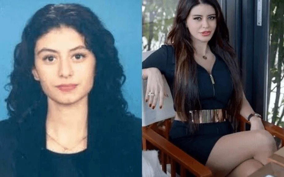 Ünlülerin hayatlarını estetik değiştirdi! Pınar Deniz, Gülsüm Ali, Melek Mosso estetiksiz halleri 26