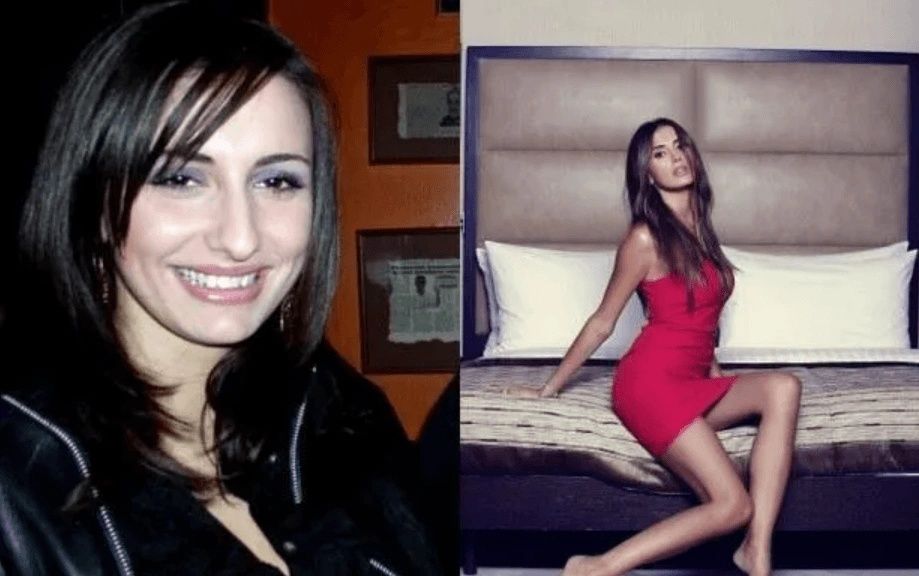 Ünlülerin hayatlarını estetik değiştirdi! Pınar Deniz, Gülsüm Ali, Melek Mosso estetiksiz halleri 27