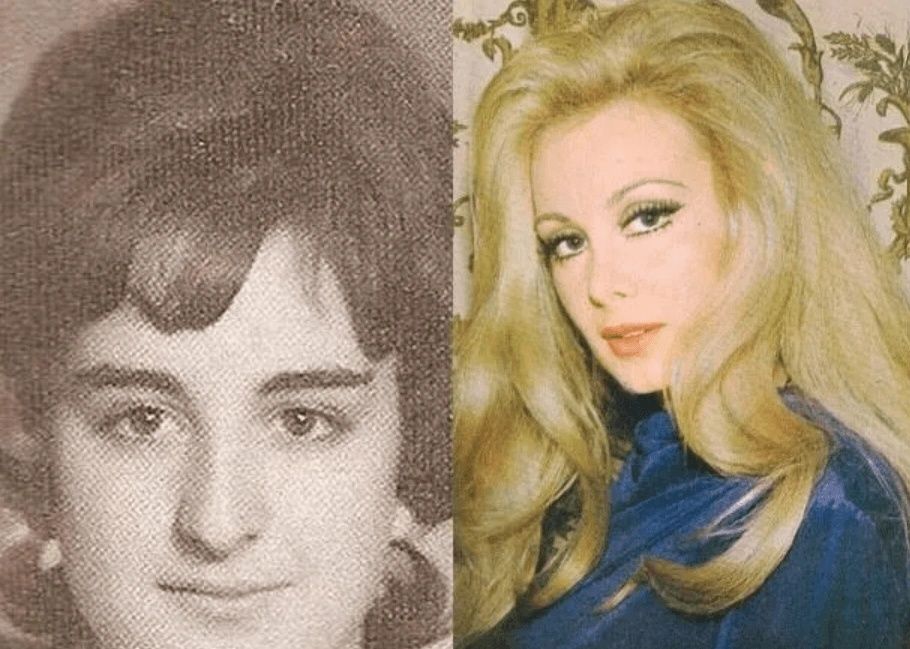 Ünlülerin hayatlarını estetik değiştirdi! Pınar Deniz, Gülsüm Ali, Melek Mosso estetiksiz halleri 30