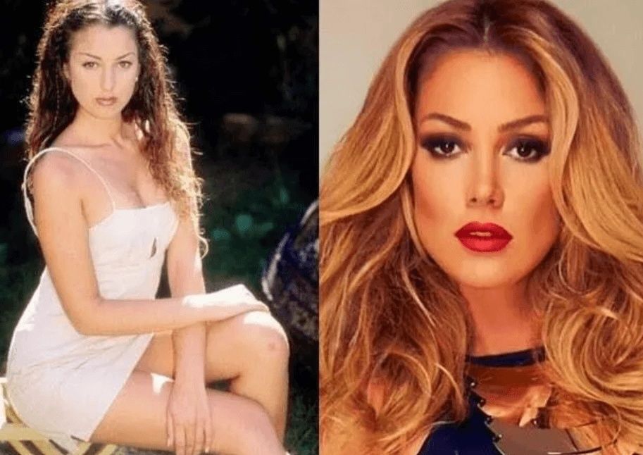 Ünlülerin hayatlarını estetik değiştirdi! Pınar Deniz, Gülsüm Ali, Melek Mosso estetiksiz halleri 31