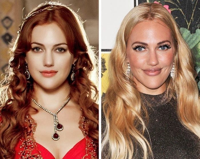 Ünlülerin hayatlarını estetik değiştirdi! Pınar Deniz, Gülsüm Ali, Melek Mosso estetiksiz halleri 33
