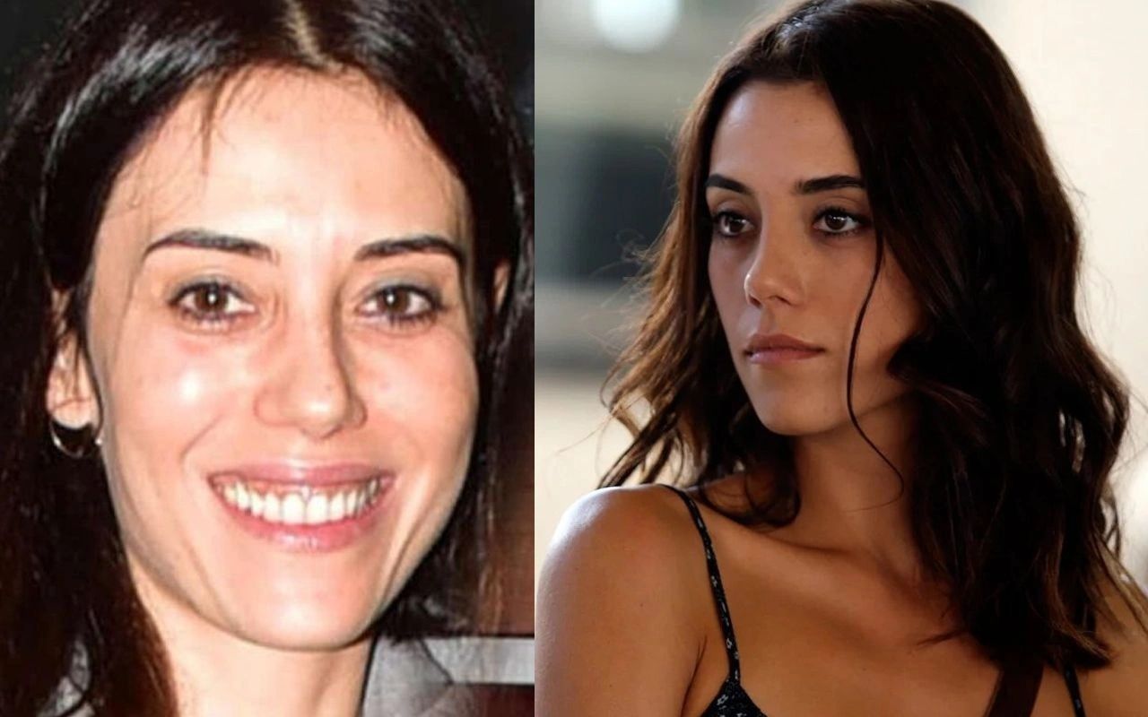 Ünlülerin hayatlarını estetik değiştirdi! Pınar Deniz, Gülsüm Ali, Melek Mosso estetiksiz halleri 34
