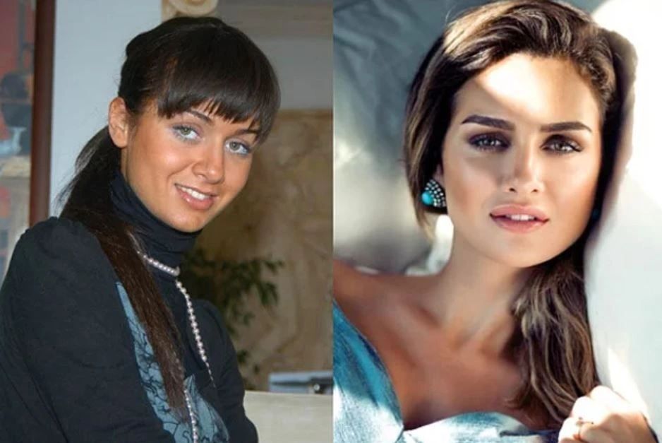 Ünlülerin hayatlarını estetik değiştirdi! Pınar Deniz, Gülsüm Ali, Melek Mosso estetiksiz halleri 35