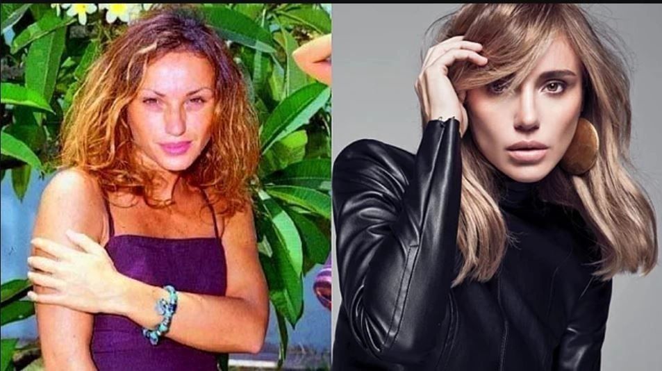 Ünlülerin hayatlarını estetik değiştirdi! Pınar Deniz, Gülsüm Ali, Melek Mosso estetiksiz halleri 36