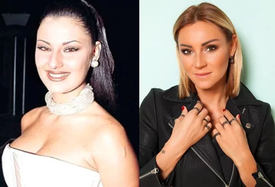 Ünlülerin hayatlarını estetik değiştirdi! Pınar Deniz, Gülsüm Ali, Melek Mosso estetiksiz halleri 38