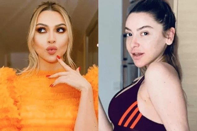 Ünlülerin Makyajsız Halleri Rüyalara Giriyor! Burcu Özberk, Ebru Şahin, Aline Boz Makyajsız Halleri! 7