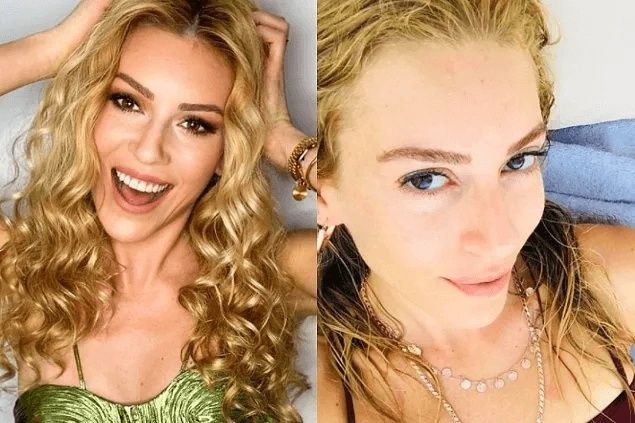 Ünlülerin Makyajsız Halleri Rüyalara Giriyor! Burcu Özberk, Ebru Şahin, Aline Boz Makyajsız Halleri! 8