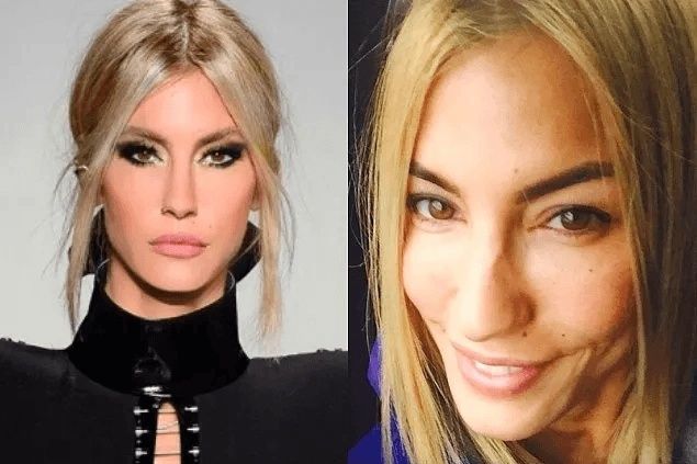 Ünlülerin Makyajsız Halleri Rüyalara Giriyor! Burcu Özberk, Ebru Şahin, Aline Boz Makyajsız Halleri! 14