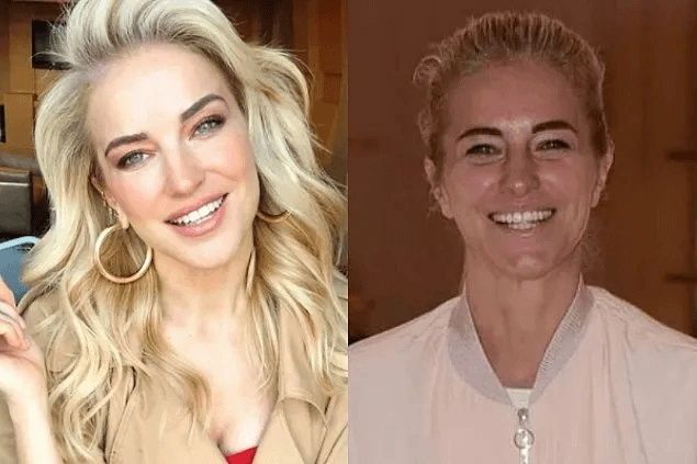 Ünlülerin Makyajsız Halleri Rüyalara Giriyor! Burcu Özberk, Ebru Şahin, Aline Boz Makyajsız Halleri! 15