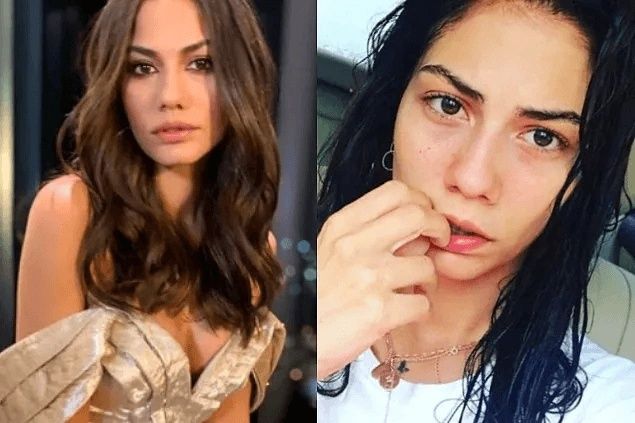 Ünlülerin Makyajsız Halleri Rüyalara Giriyor! Burcu Özberk, Ebru Şahin, Aline Boz Makyajsız Halleri! 17