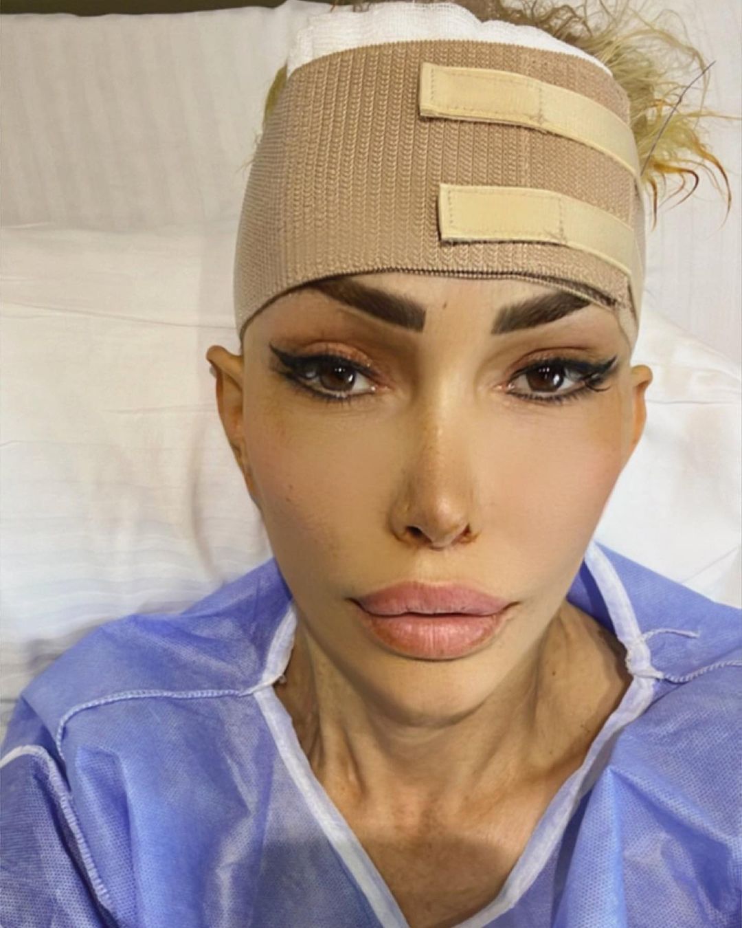 Ata Çağlayan'la aşk yaşayan Seyhan Soylu son haliyle Seda Sayan'a benzetilince bir estetik operasyon daha geçirdi 10