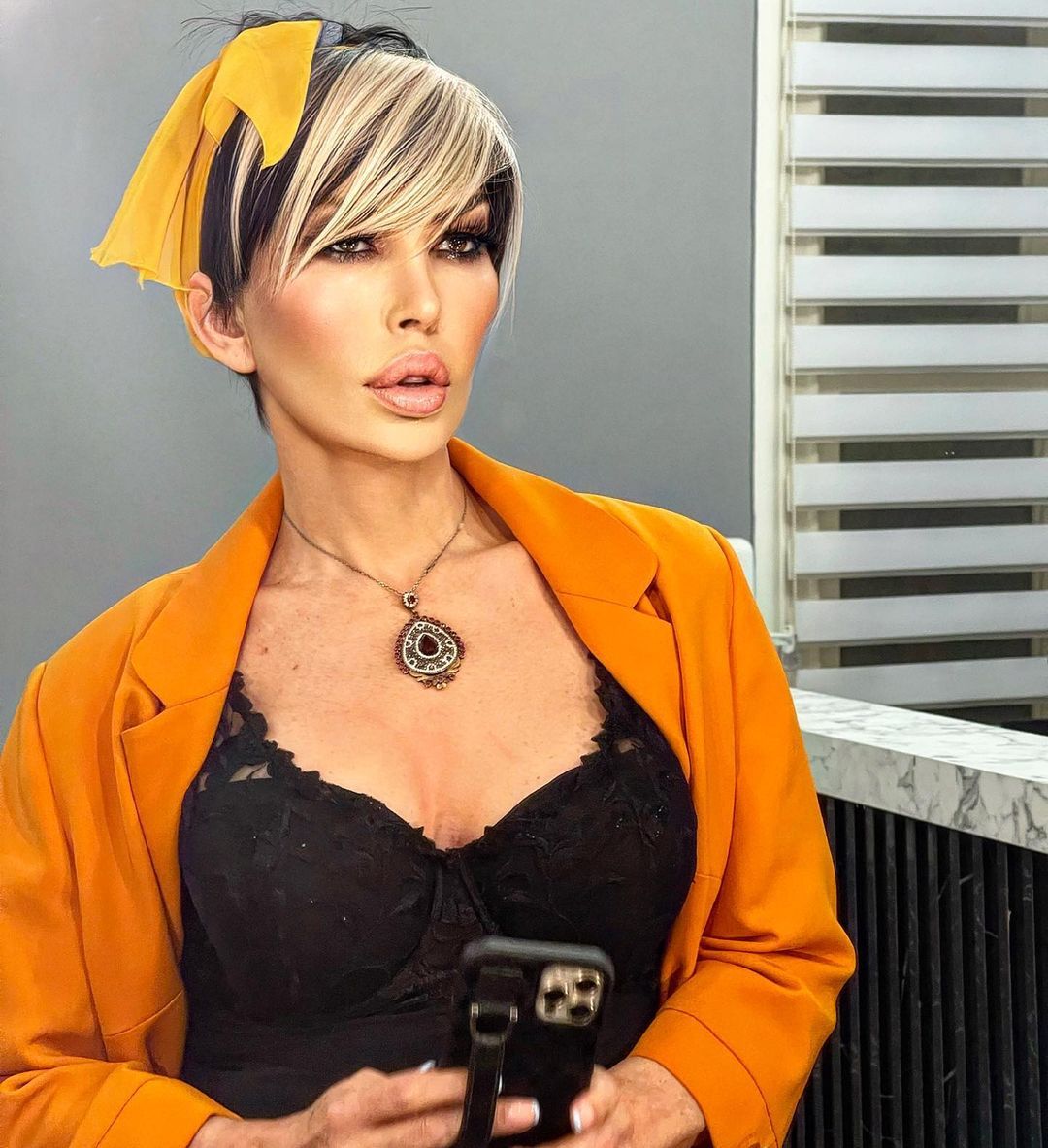 Ata Çağlayan'la aşk yaşayan Seyhan Soylu son haliyle Seda Sayan'a benzetilince bir estetik operasyon daha geçirdi 20