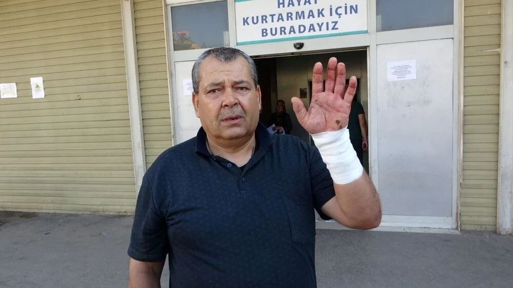 Bir bayram klasiği: Acemi kasaplar acil servislere akın etti! 7
