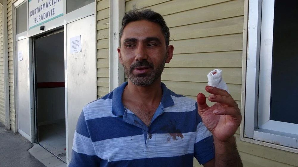 Bir bayram klasiği: Acemi kasaplar acil servislere akın etti! 18