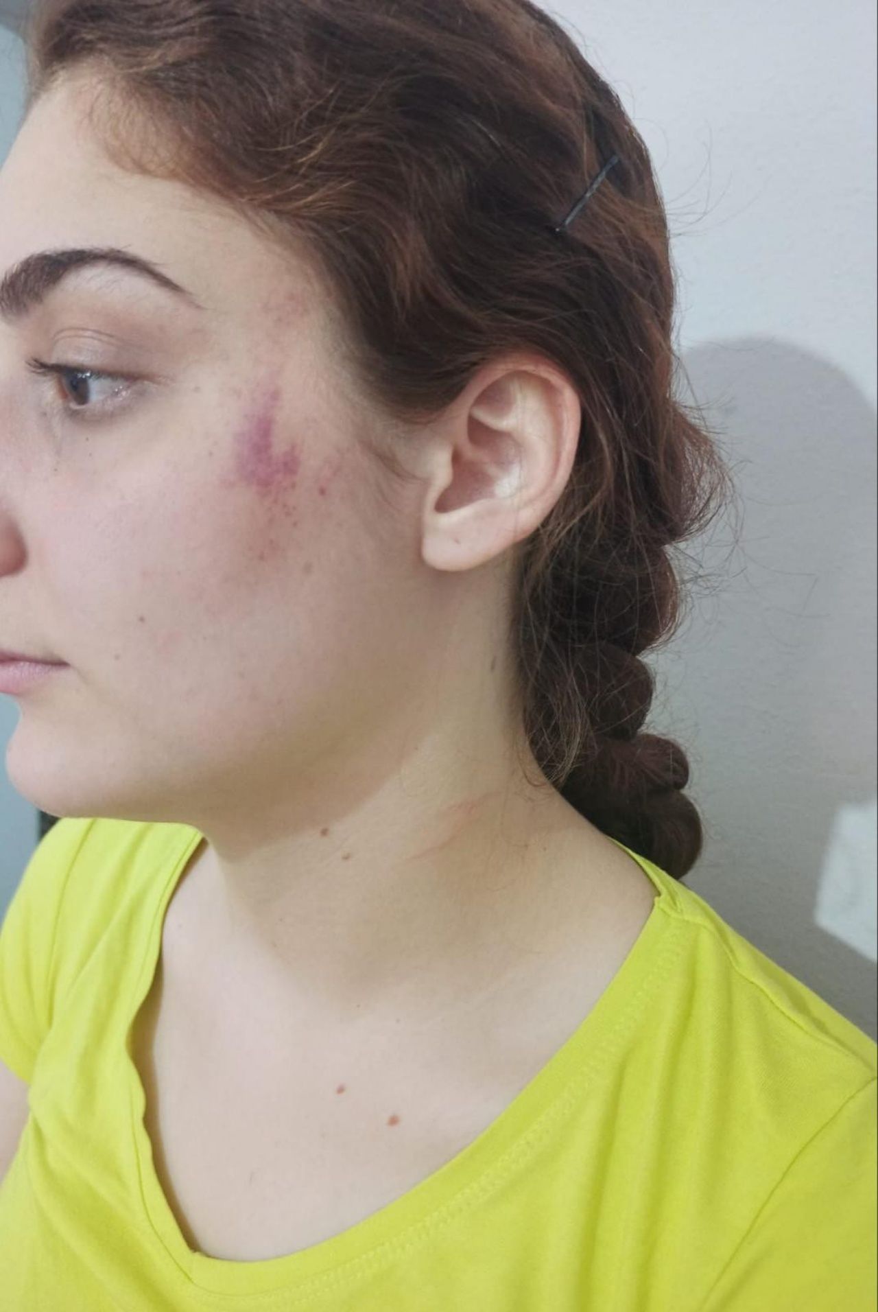 Acılı annenin yardım çığlıkları! Sokakta oynaması için gönderdiği kızına 3 aydır ulaşamıyor 3