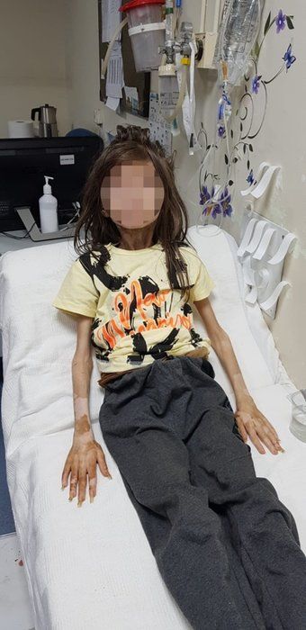 Bursa'da çöp evde mahsur kalan Cem Muhammed'in son hali ortaya çıktı! İlk isteği bakın ne olmuş... 7