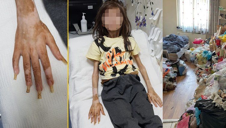 Bursa'da çöp evde mahsur kalan Cem Muhammed'in son hali ortaya çıktı! İlk isteği bakın ne olmuş... 4