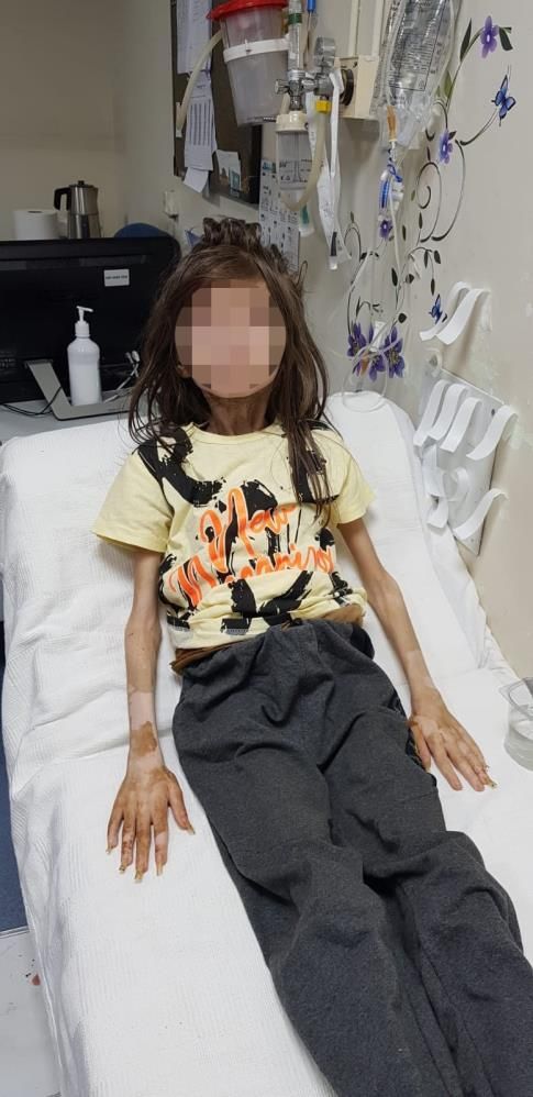 Çöp evde yeğenini mahsur bırakan teyzeden akılalmaz savunma: Annesi olmadığımı öğrenince hayata küstü! 3