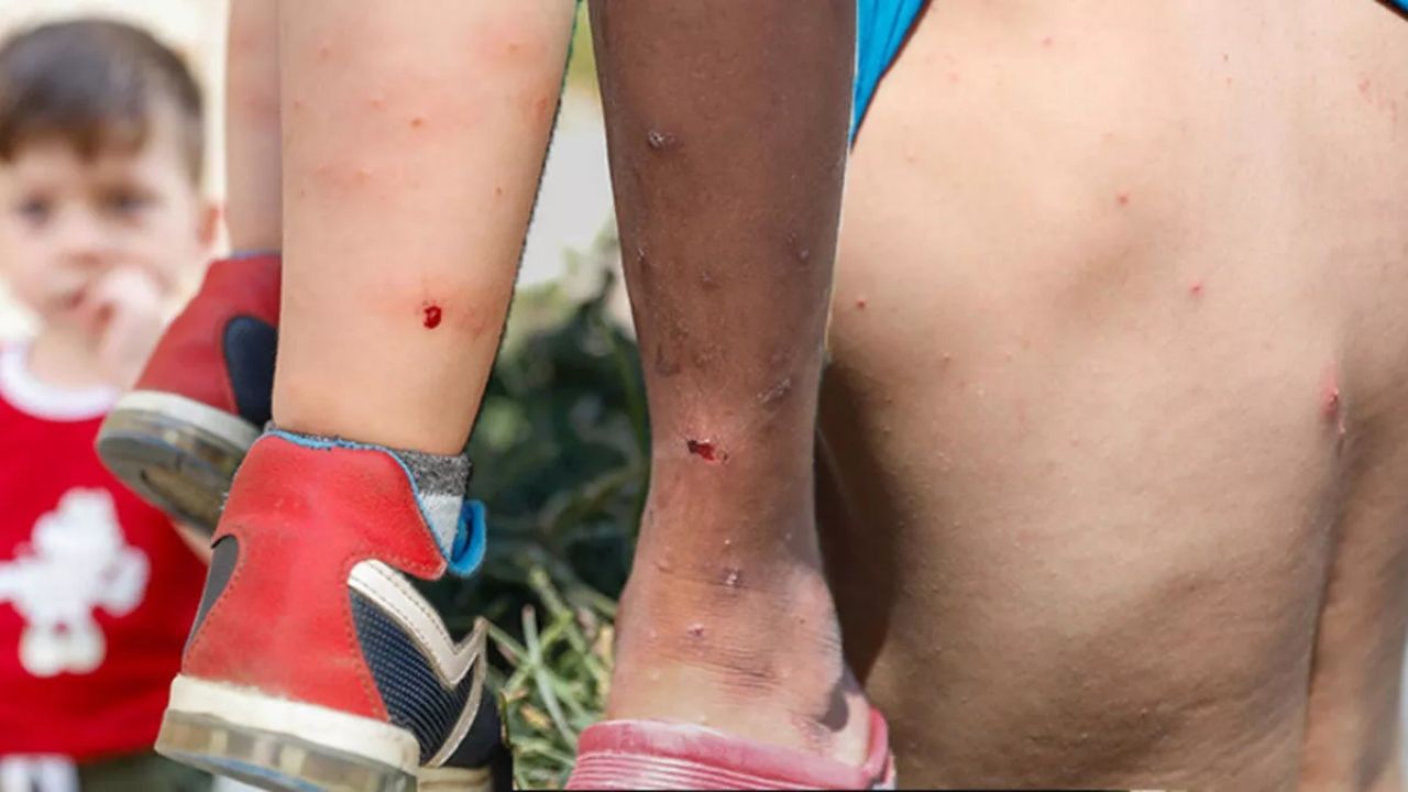 İstanbul'da 'Aedes' sineği alarmı: Zika virüsü bulaştırıyor! İlaçlamak da yeterli değil... 1
