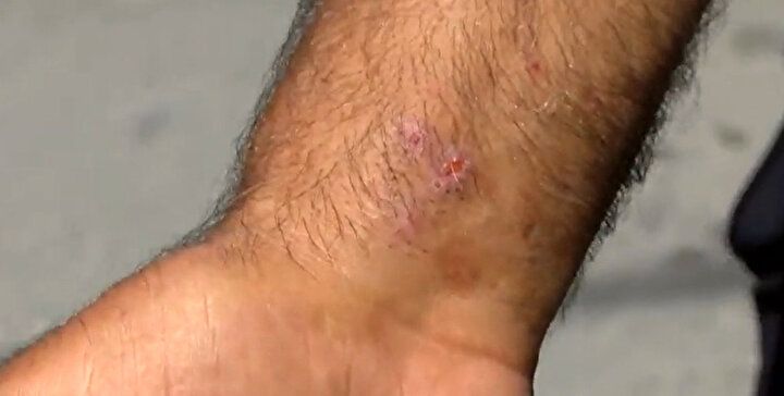 İstanbul'da 'Aedes' sineği alarmı: Zika virüsü bulaştırıyor! İlaçlamak da yeterli değil... 5