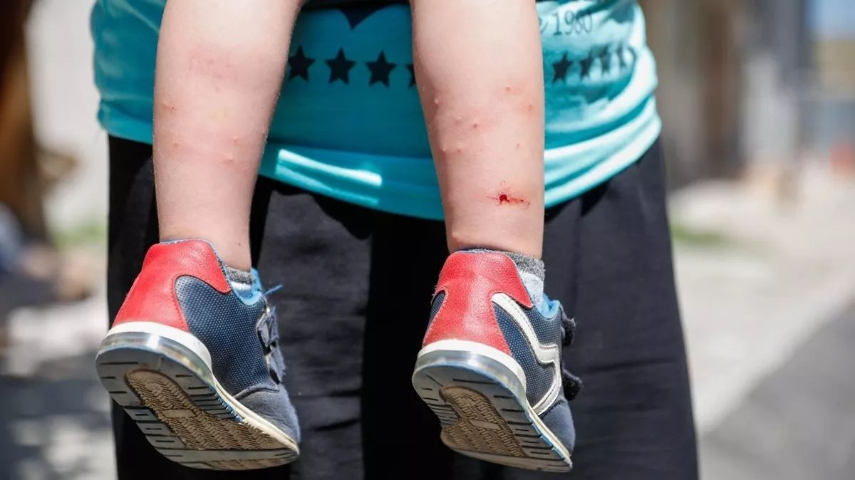 İstanbul'da 'Aedes' sineği alarmı: Zika virüsü bulaştırıyor! İlaçlamak da yeterli değil... 4