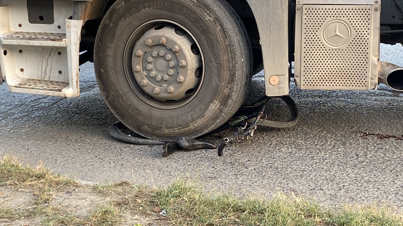 Bisiklet sürerken TIR'ın altında kalan 11 yaşındaki çocuğun bacağı koptu 1