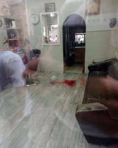 Berber koltuğunda dehşet: Tıraş olurken silahlı saldırıya uğradı 6