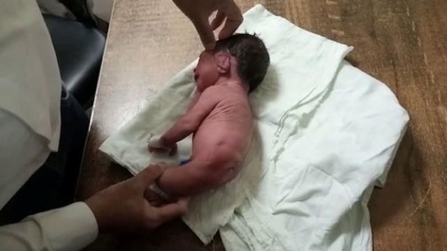 Yeni doğan bebeği gören doktorlar hayrete düştü! 3