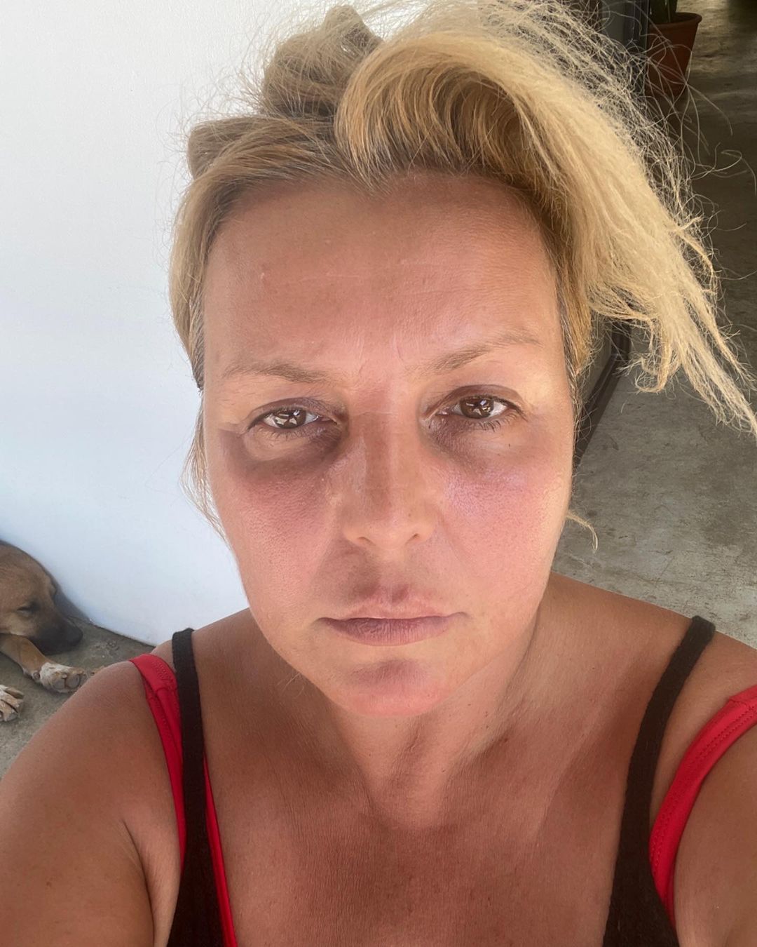 Seda Akgül'ün gerçek yüzü ortaya çıktı: Makyajsız fotoğrafını paylaştı 3