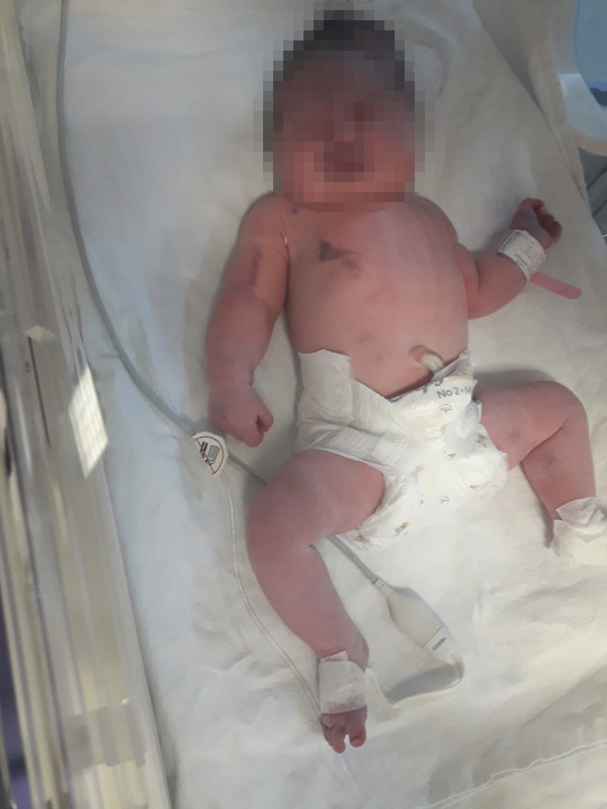 Hastanede skandal olay: Temizlik görevlisi doğum yaptırdı! Bebek sakat kaldı... 6