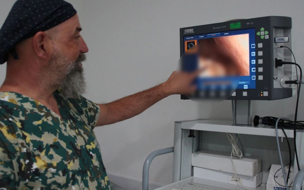 'Sürekli hapşırma' şikayetiyle doktora gitti hayatının şokunu yaşadı! Öyle bir şey çıktı ki... 1