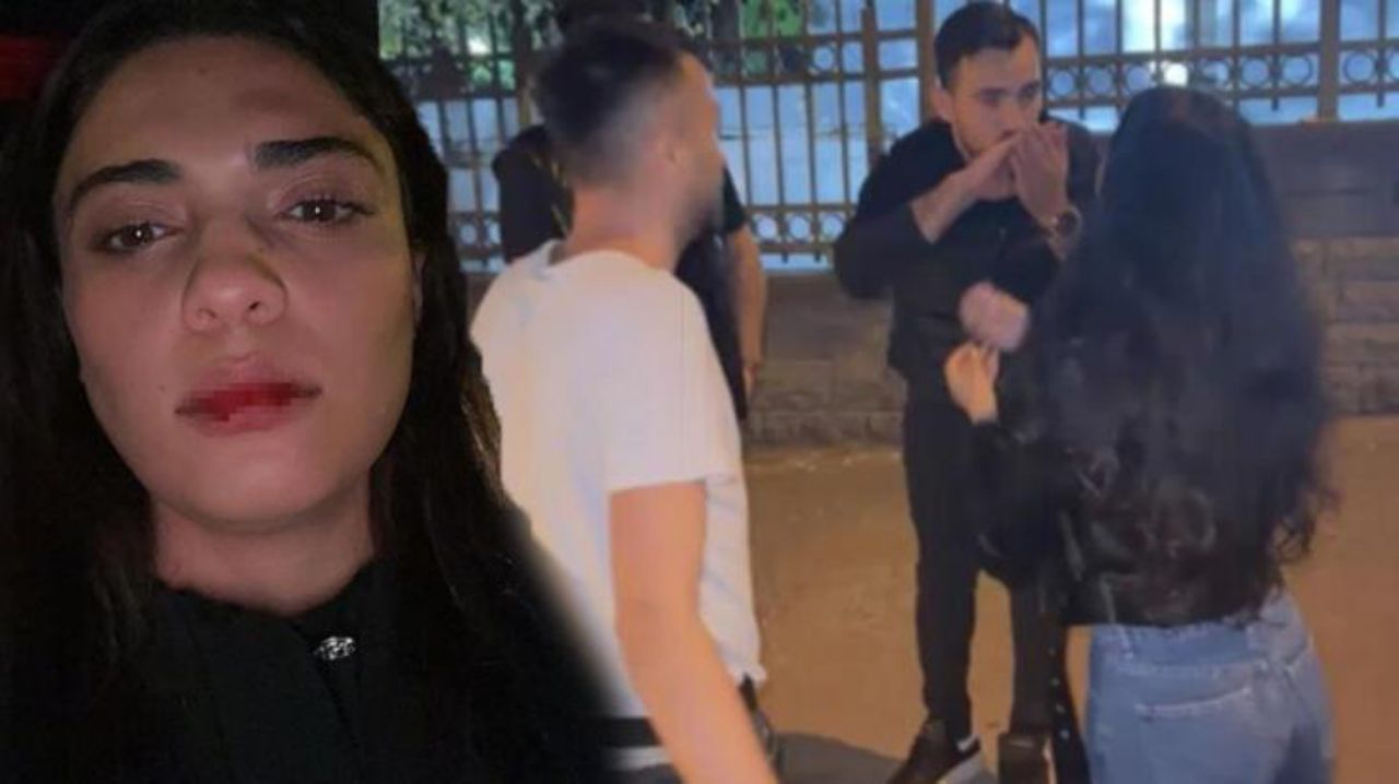 Azeybaycanlı şarkıcı İstanbul’da darp edildi 3