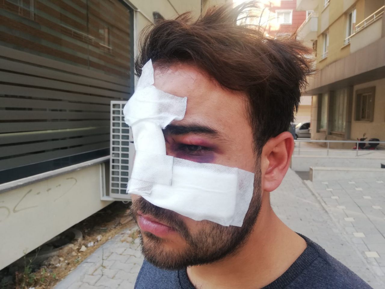 Hatay’da istek şarkıyı bilmeyen müzisyenin yüzünde şişe kırdılar 1