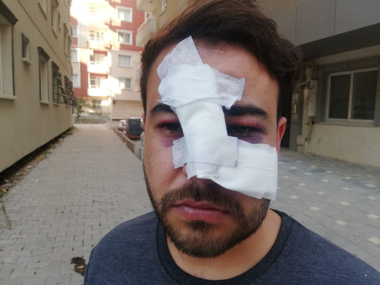 Hatay’da istek şarkıyı bilmeyen müzisyenin yüzünde şişe kırdılar 6