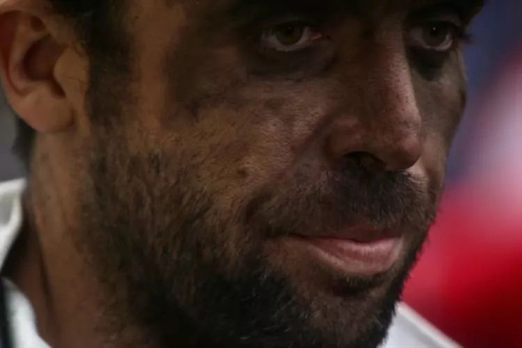 Bartın'daki maden patlamasından geriye kalan acı görüntüler! 24