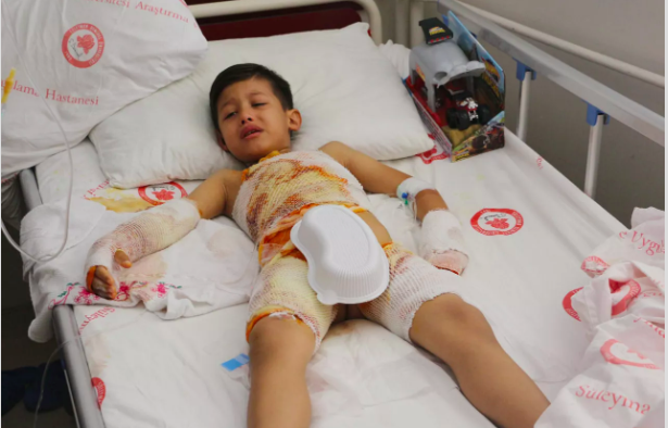 Isparta'da anaokulunda facia: 6 yaşındaki çocuğun üzerine kaynar su döküldü 3