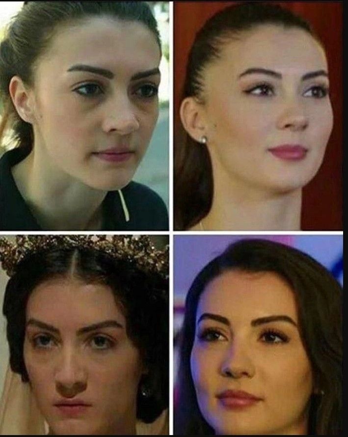 Burcu Özberk Estetiksiz De Şaşırttı! Oyuncu Burcu Özberk'in Eski Halin Görenler Yorum Yağdırdı 15