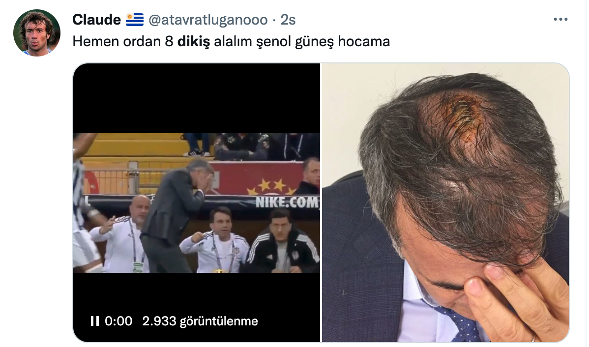 Güneş’in kafasına top gelince sosyal medya yıkıldı! 3